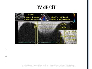 RIGHT VENTRICLE ANATOMY,PHYSIOLOGY, ASSESSMENT & CLINICAL SIGNIFICANCE
RV dP/dT
• Time required for the TR jet to increase in velocity from 1 to 2
m/s
• The dP/dt is therefore calculated as 12 mm Hg divided by this
time (in seconds), yielding a value in mm of Hg per second.
• RV dP/dt < 400 mm Hg/s is likely abnormal
 