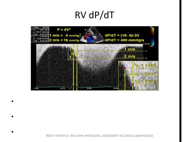 Right ventricle (RV) anatomy and functions | PPT | Heart and ...