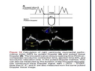 RIGHT VENTRICLE ANATOMY,PHYSIOLOGY, ASSESSMENT & CLINICAL SIGNIFICANCE
 