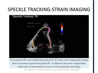 RIGHT VENTRICLE ANATOMY,PHYSIOLOGY, ASSESSMENT & CLINICAL SIGNIFICANCE
SPECKLE TRACKING-STRAIN IMAGING
 