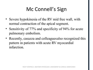 RIGHT VENTRICLE ANATOMY,PHYSIOLOGY, ASSESSMENT & CLINICAL SIGNIFICANCE
Mc Connell’s Sign
• Severe hypokinesia of the RV mid free wall, with
normal contraction of the apical segment.
• Sensitivity of 77% and specificity of 94% for acute
pulmonary embolism.
• Recently, casazza and colleaguesalso recognized this
pattern in patients with acute RV myocardial
infarction.
 