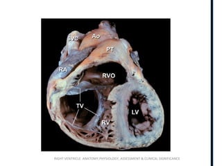 RIGHT VENTRICLE ANATOMY,PHYSIOLOGY, ASSESSMENT & CLINICAL SIGNIFICANCE
 