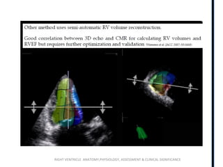 RIGHT VENTRICLE ANATOMY,PHYSIOLOGY, ASSESSMENT & CLINICAL SIGNIFICANCE
 