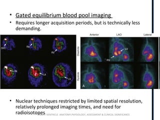 RIGHT VENTRICLE ANATOMY,PHYSIOLOGY, ASSESSMENT & CLINICAL SIGNIFICANCE
• Gated equilibrium blood pool imaging
• Requires longer acquisition periods, but is technically less
demanding.
• Nuclear techniques restricted by limited spatial resolution,
relatively prolonged imaging times, and need for
radioisotopes
 