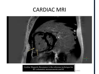 RIGHT VENTRICLE ANATOMY,PHYSIOLOGY, ASSESSMENT & CLINICAL SIGNIFICANCE
CARDIAC MRI
 