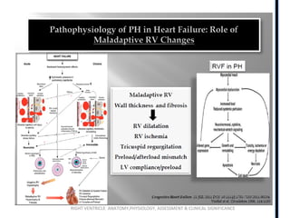 RIGHT VENTRICLE ANATOMY,PHYSIOLOGY, ASSESSMENT & CLINICAL SIGNIFICANCE
 