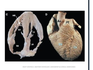 RIGHT VENTRICLE ANATOMY,PHYSIOLOGY, ASSESSMENT & CLINICAL SIGNIFICANCE
 