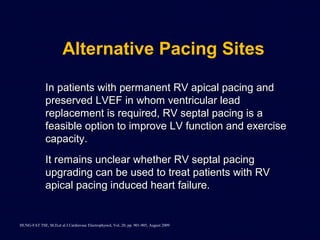 Traditional Rv Pacing Right ventricular pacing revisited | PPT