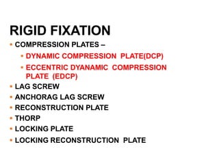 RIGID INTERNAL.pptx