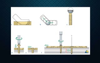 Semi Rigid Fixation Examples Rigid internal fixation | PPTX