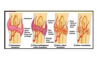 Rigid internal fixation | PPTX
