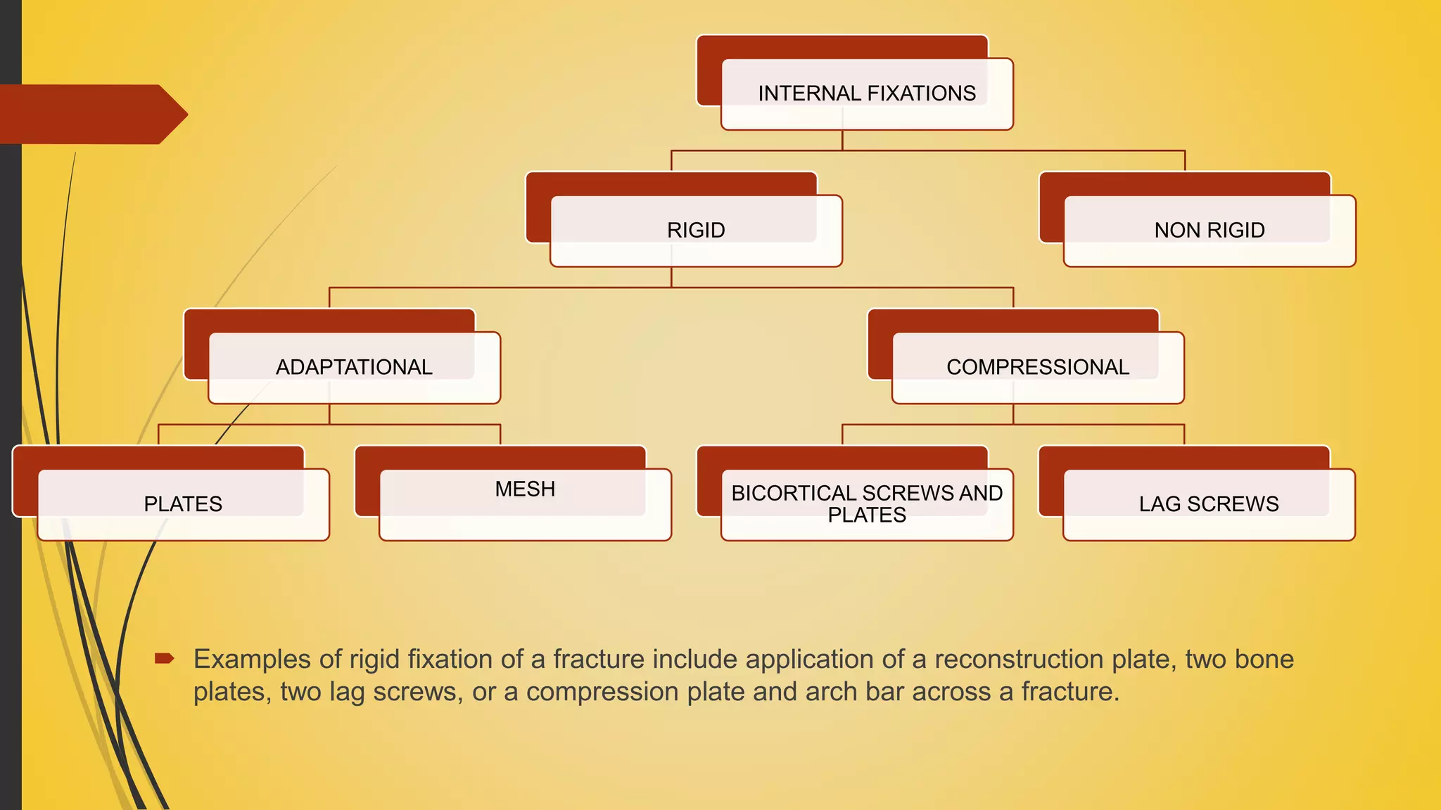  Examples of rigid fixation of a fracture include application of a reconstruction plate, two bone
plates, two lag screws, or a compression plate and arch bar across a fracture.
INTERNAL FIXATIONS
RIGID
ADAPTATIONAL
PLATES
MESH
COMPRESSIONAL
BICORTICAL SCREWS AND
PLATES
LAG SCREWS
NON RIGID
 