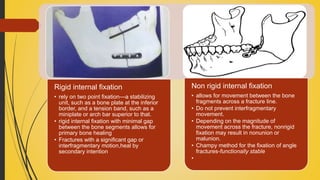 Rigid internal fixation
• rely on two point fixation—a stabilizing
unit, such as a bone plate at the inferior
border, and a tension band, such as a
miniplate or arch bar superior to that.
• rigid internal fixation with minimal gap
between the bone segments allows for
primary bone healing
• Fractures with a significant gap or
interfragmentary motion,heal by
secondary intention
Non rigid internal fixation
• allows for movement between the bone
fragments across a fracture line.
• Do not prevent interfragmentary
movement.
• Depending on the magnitude of
movement across the fracture, nonrigid
fixation may result in nonunion or
malunion.
• Champy method for the fixation of angle
fractures-functionally stable
•
 