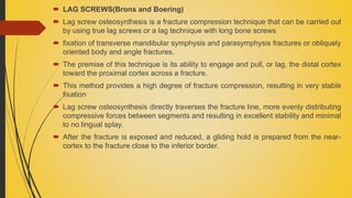  LAG SCREWS(Brons and Boering)
 Lag screw osteosynthesis is a fracture compression technique that can be carried out
by using true lag screws or a lag technique with long bone screws
 fixation of transverse mandibular symphysis and parasymphysis fractures or obliquely
oriented body and angle fractures.
 The premise of this technique is its ability to engage and pull, or lag, the distal cortex
toward the proximal cortex across a fracture.
 This method provides a high degree of fracture compression, resulting in very stable
fixation
 Lag screw osteosynthesis directly traverses the fracture line, more evenly distributing
compressive forces between segments and resulting in excellent stability and minimal
to no lingual splay.
 After the fracture is exposed and reduced, a gliding hold is prepared from the near-
cortex to the fracture close to the inferior border.
 