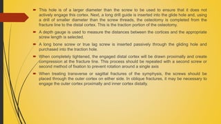  This hole is of a larger diameter than the screw to be used to ensure that it does not
actively engage this cortex. Next, a long drill guide is inserted into the glide hole and, using
a drill of smaller diameter than the screw threads, the osteotomy is completed from the
fracture line to the distal cortex. This is the traction portion of the osteotomy.
 A depth gauge is used to measure the distances between the cortices and the appropriate
screw length is selected.
 A long bone screw or true lag screw is inserted passively through the gliding hole and
purchased into the traction hole.
 When completely tightened, the engaged distal cortex will be drawn proximally and create
compression at the fracture line. This process should be repeated with a second screw or
second method of fixation to prevent rotation around a single axis
 When treating transverse or sagittal fractures of the symphysis, the screws should be
placed through the outer cortex on either side. In oblique fractures, it may be necessary to
engage the outer cortex proximally and inner cortex distally.
 