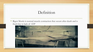 Definition
• Rigor Mortis is normal muscle contraction that occurs after death and is
fixed due to lack of ATP
 