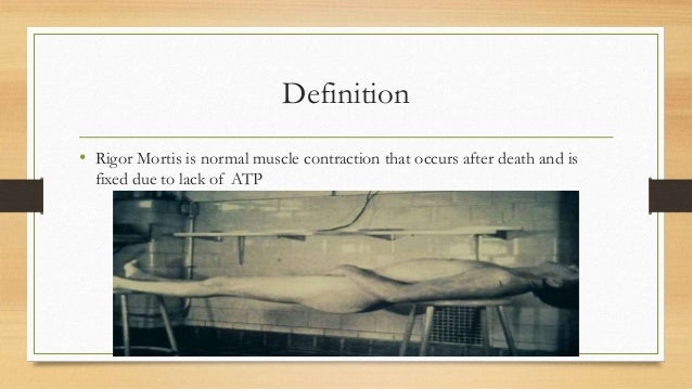 rigor-mortis
