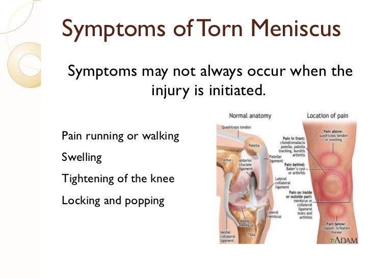 Rikki's meniscus presentation