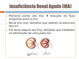Insuficiência Renal Aguda (IRA)
 Pré-renal (antes dos rins)  redução do fluxo
sanguíneo para os rins;
 Renal (nos rins): distúrbios que alteram as estruturas
dos rins;
 Pós renal (depois dos rins): distúrbios que interferem
na eliminação de urina pelos rins.
 