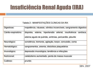 Insuficiência Renal Aguda (IRA)
SBN, 2007
 