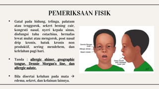 Rhinitis Alergi Rina Purnama Sari IKA FK | PPTX
