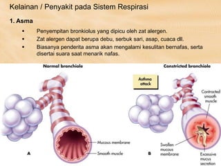 Kelainan / Penyakit pada Sistem Respirasi
 Penyempitan bronkiolus yang dipicu oleh zat alergen.
 Zat alergen dapat berupa debu, serbuk sari, asap, cuaca dll.
 Biasanya penderita asma akan mengalami kesulitan bernafas, serta
disertai suara saat menarik nafas.
1. Asma
 