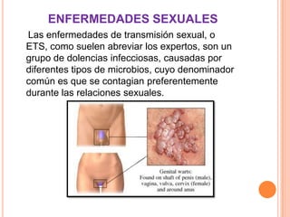 ENFERMEDADES SEXUALES
Las enfermedades de transmisión sexual, o
ETS, como suelen abreviar los expertos, son un
grupo de dolencias infecciosas, causadas por
diferentes tipos de microbios, cuyo denominador
común es que se contagian preferentemente
durante las relaciones sexuales.
 