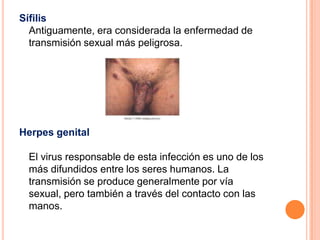 Sífilis
  Antiguamente, era considerada la enfermedad de
  transmisión sexual más peligrosa.




Herpes genital

 El virus responsable de esta infección es uno de los
 más difundidos entre los seres humanos. La
 transmisión se produce generalmente por vía
 sexual, pero también a través del contacto con las
 manos.
 