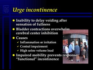 Üriner İnkontinans - www.jinekolojivegebelik.com - Delayed Incontinence Issues