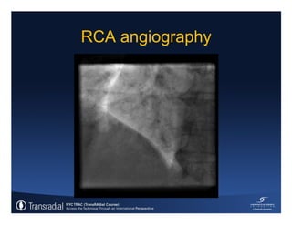 Rinfret S - Case of bleeding, compartment syndrome