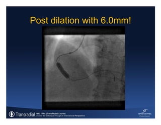 Rinfret S - Case of bleeding, compartment syndrome