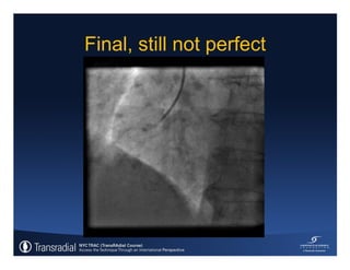 Rinfret S - Case of bleeding, compartment syndrome