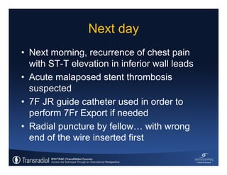 Rinfret S - Case of bleeding, compartment syndrome