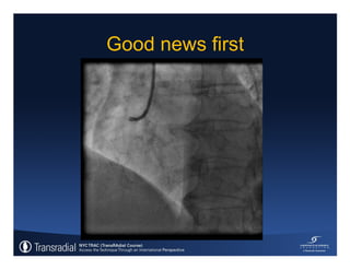 Rinfret S - Case of bleeding, compartment syndrome