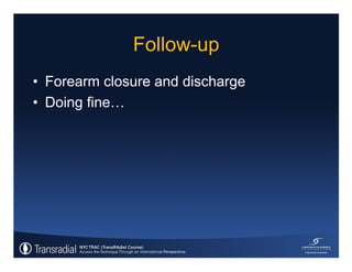 Rinfret S - Case of bleeding, compartment syndrome