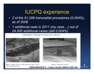 Rinfret S - Case of bleeding, compartment syndrome