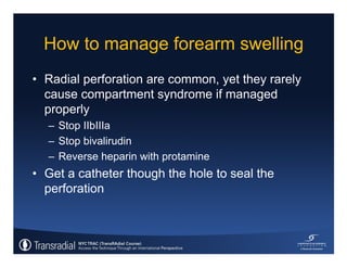 Rinfret S - Case of bleeding, compartment syndrome