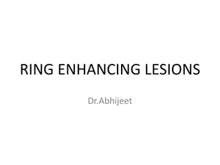 RING ENHANCING LESIONS
Dr.Abhijeet
 