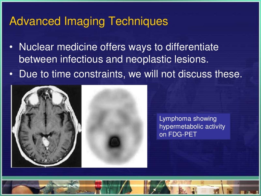 Ring Enhancing Lesions