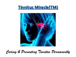 Tinnitus Miracle(TM)Tinnitus Miracle(TM)
Curing & Preventing Tinnitus PermanentlyCuring & Preventing Tinnitus Permanently
 