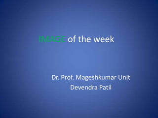 IMAGE of the week Dr. Prof. Mageshkumar Unit  DevendraPatil 