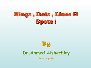 Rings , Dots , Lines &Rings , Dots , Lines &
Spots !Spots !
By
Dr.Ahmed Alsherbiny
MSc. Ophth
 