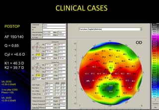 Rings chosen based on asphericity | PDF