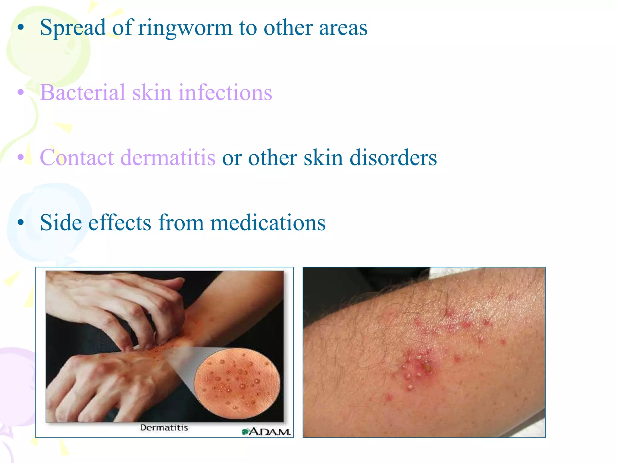 Spread of ringworm to other areas  Bacterial skin infections   Contact dermatitis  or other skin disorders Side effects from medications  
