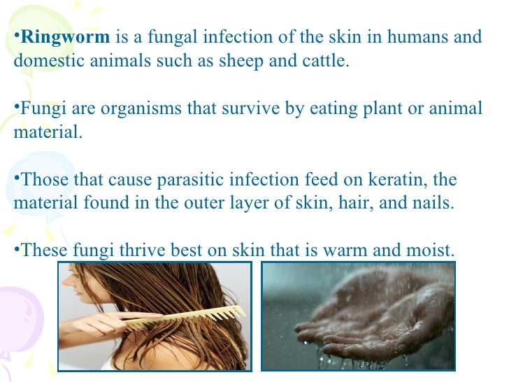 Different Types Of Ringworm