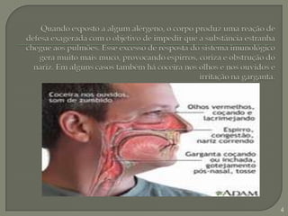 Quando exposto a algum alérgeno, o corpo produz uma reação de defesa exagerada com o objetivo de impedir que a substância estranha chegue aos pulmões. Esse excesso de resposta do sistema imunológico gera muito mais muco, provocando espirros, coriza e obstrução do nariz. Em alguns casos também há coceira nos olhos e nos ouvidos e irritação na garganta.4