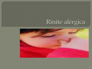 Rinite alérgica 1 