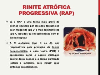 RINITE ATRÓFICA
PROGRESSIVA (RAP)
 Já a RAP é uma forma mais grave da
doença causada por isolados toxigênicos
da P. multocida tipo D, e mais raramente do
tipo A, isolados ou em combinação com B.
bronchiseptica.
 A P. multocida (tipo D ou A), são
responsáveis pela produção da toxina
dermonecrótica, e essa toxina (PMT) é
apresentada como o agente etiológico
central desta doença e a toxina purificada
isolada é suficiente para induzir seus
sintomas característicos.
Fig 10. Rinite Atrófica grave.
 