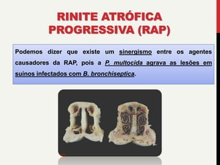 RINITE ATRÓFICA
PROGRESSIVA (RAP)
Podemos dizer que existe um sinergismo entre os agentes
causadores da RAP, pois a P. multocida agrava as lesões em
suínos infectados com B. bronchiseptica.
 