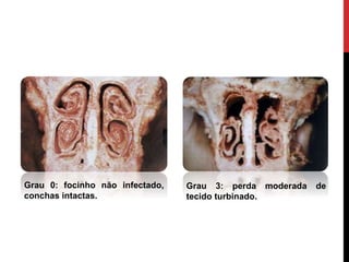Grau 0: focinho não infectado,
conchas intactas.
Grau 3: perda moderada de
tecido turbinado.
 
